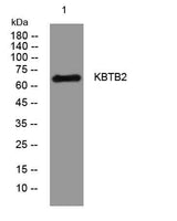KBTB2 rabbit pAb