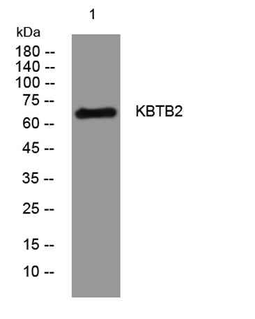 KBTB2 rabbit pAb