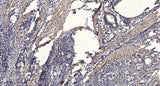 Jak1(phospho-Tyr1034/1035) rabbit pAb 50µL/100µL