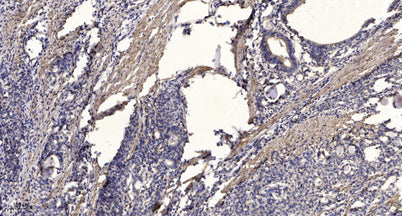 Jak1(phospho-Tyr1034/1035) rabbit pAb 50µL/100µL