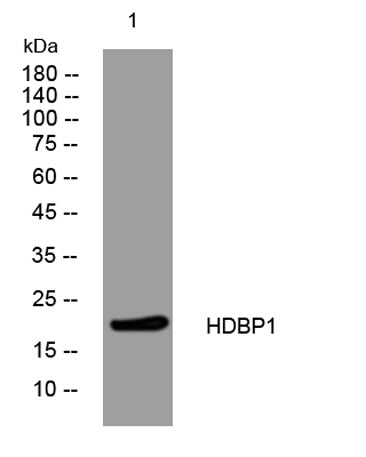 HDBP1 rabbit pAb 50µL/100µL