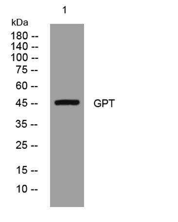 GPT rabbit pAb 50µL/100µL