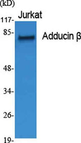 Adducin β rabbit pAb