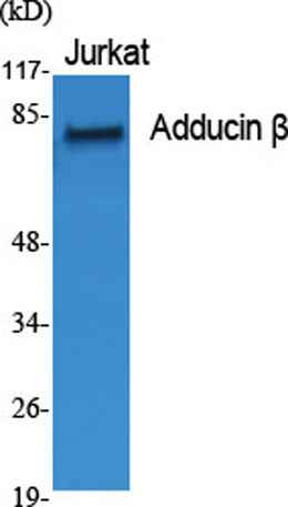 Adducin β rabbit pAb