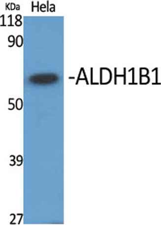 ALDH1B1 rabbit pAb