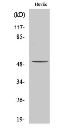ALDH3B1 rabbit pAb 50µL/100µL