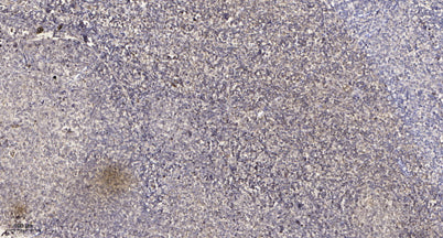 FKBP1B Rabbit pAb 50µL/100µL