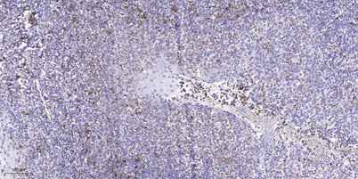 EPHA1 (Phospho-Tyr605) rabbit pAb
