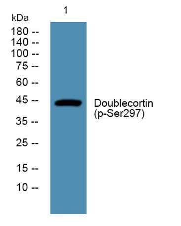 Doublecortin (phospho-Ser297) rabbit pAb
