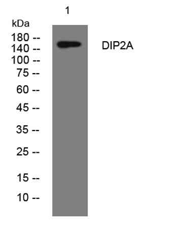 DIP2A rabbit pAb
