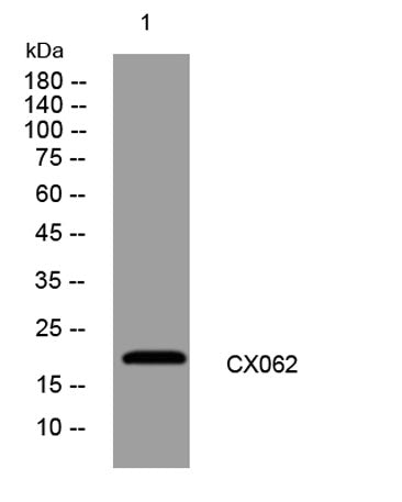 CX062 rabbit pAb 50µL/100µL