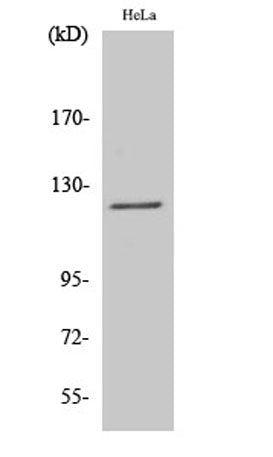 Atrophin-1 rabbit pAb 50µL/100µL