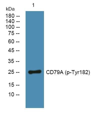 CD79A (phospho-Tyr182) rabbit pAb 50µL/100µL