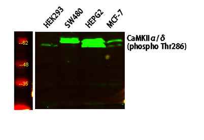 CaMK2 (Phospho-Thr286) Rabbit pAb
