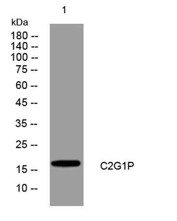C2G1P rabbit pAb