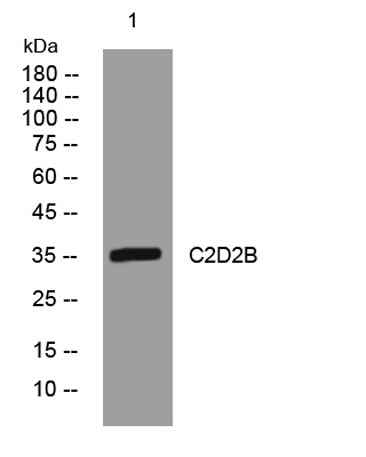C2D2B rabbit pAb