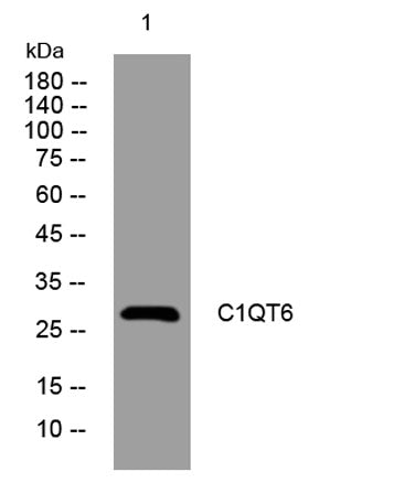 C1QT6 rabbit pAb 50µL/100µL