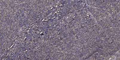Beta-defensin 1 Rabbit pAb