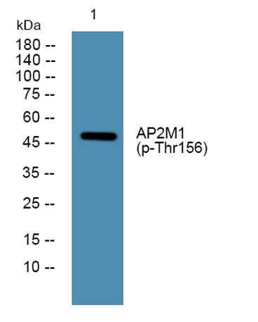 AP2M1 (phospho-Thr156) rabbit pAb