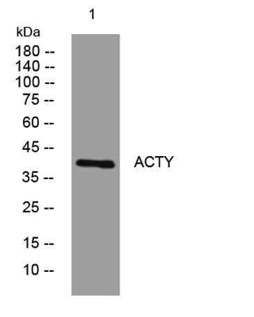 ACTY rabbit pAb