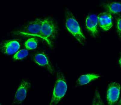 Catenin-α E/N rabbit pAb