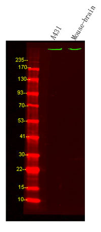 ASH1L rabbit pAb 50µL/100µL