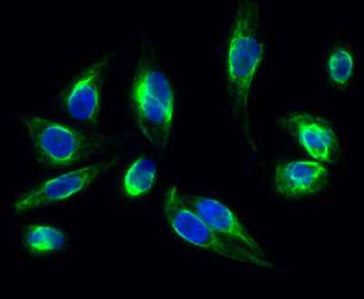 Clusterin rabbit pAb