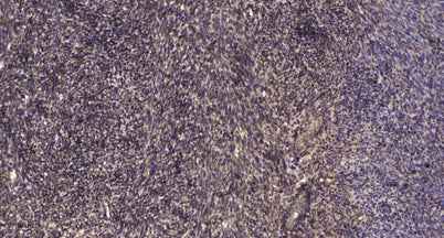NFAT1 (Phospho Ser326) rabbit pAb