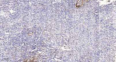 Smad1 (Phospho Ser214) rabbit pAb