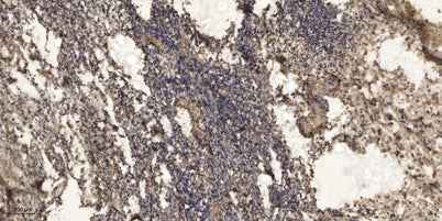 Rb (Phospho Thr252) rabbit pAb
