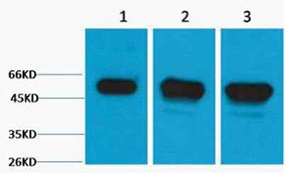 β III Tubulin rabbit pAb