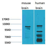 CaVα2δ3 rabbit pAb 50µL/100µL