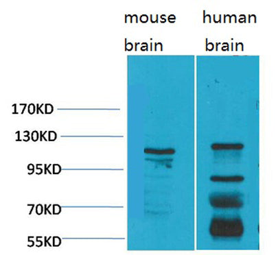 CaVα2δ3 rabbit pAb 50µL/100µL