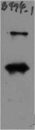 SARS-COV-2 Spike Protein S1 Rabbit pAb