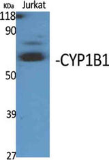 CYP1B1 rabbit pAb