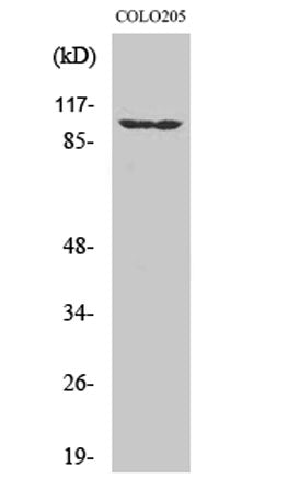 EphA1 rabbit pAb 50µL/100µL