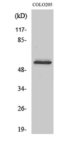 Glucagon Receptor rabbit pAb