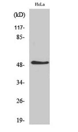 IL-11Rα rabbit pAb