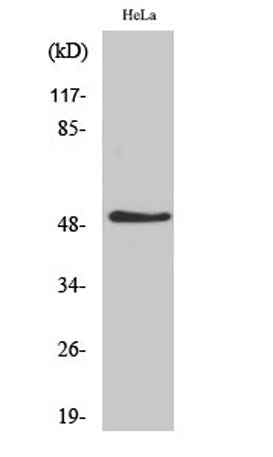 IL-11Rα rabbit pAb
