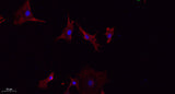 LATS1/2 rabbit pAb 50µL/100µL