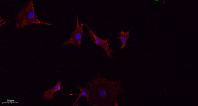 LATS1/2 rabbit pAb 50µL/100µL