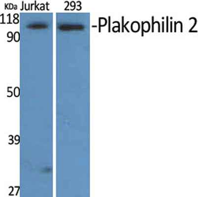 Plakophilin 2 rabbit pAb