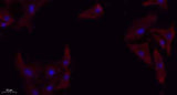 TGFβ RI rabbit pAb