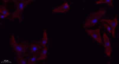 TGFβ RI rabbit pAb