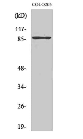 TLK2 rabbit pAb
