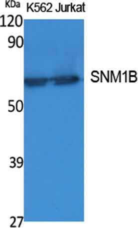 SNM1B rabbit pAb