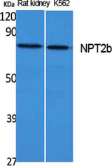 NPT2b rabbit pAb