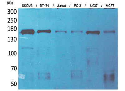 SCP-2 rabbit pAb 50µL/100µL