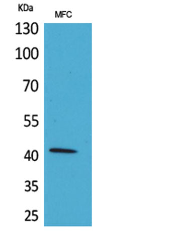 α-SMA rabbit pAb 50µL/100µL