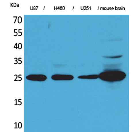 UCH-L1 rabbit pAb
